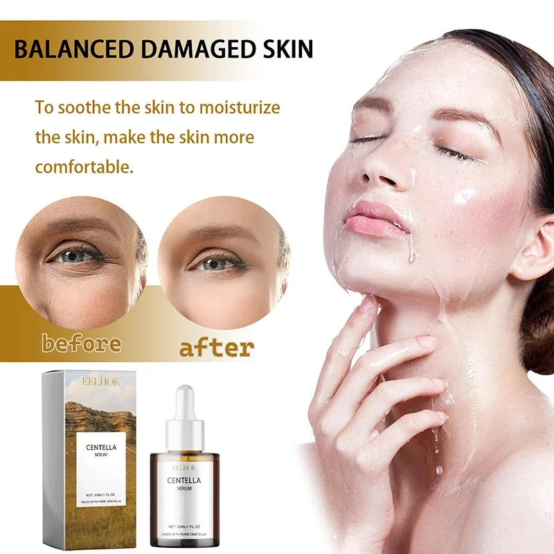 MaisonVerde® Centella Asiatica Face Serum – Deep Moisturising & Skin Soothing | Brightening Korean Facial Moisturiser for Dry & Damaged Skin