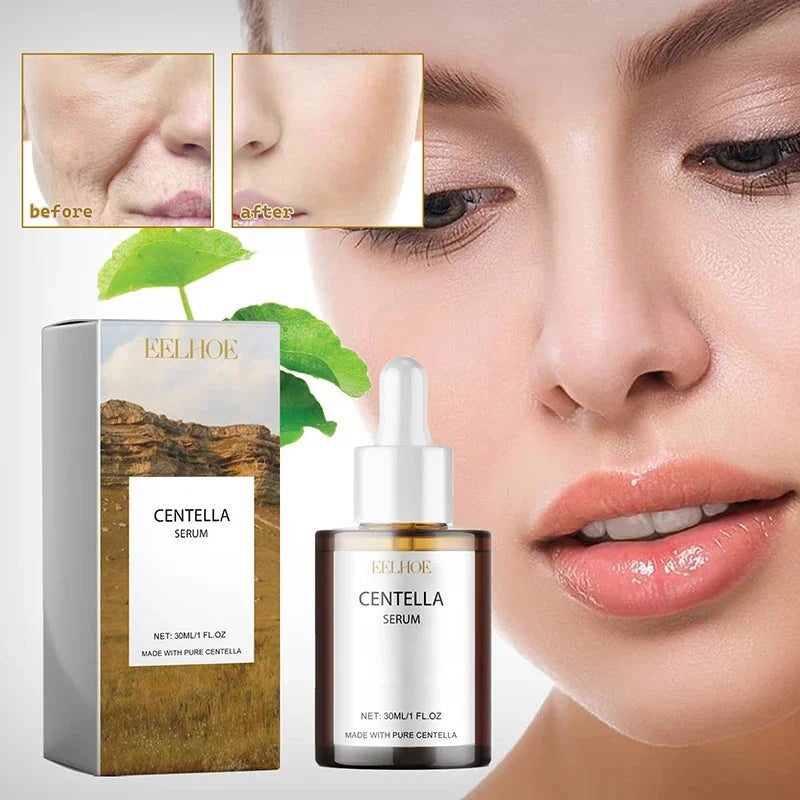 MaisonVerde® Centella Asiatica Face Serum – Deep Moisturising & Skin Soothing | Brightening Korean Facial Moisturiser for Dry & Damaged Skin